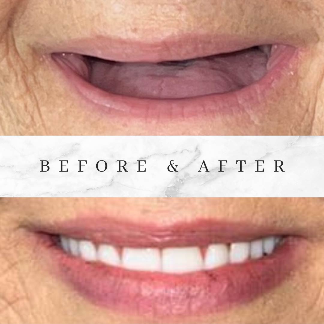 Voit Dental Smile Gallery