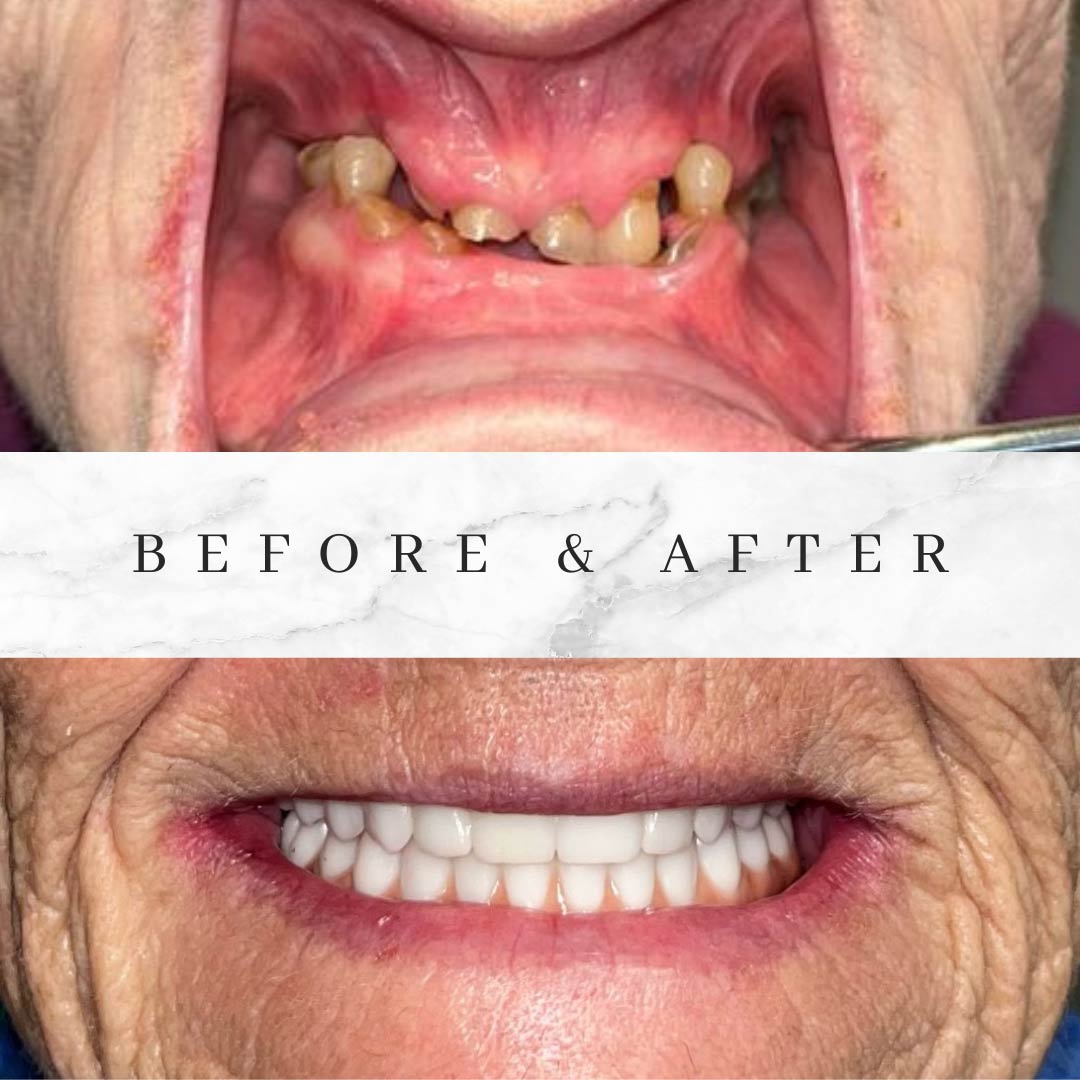 Voit Dental Smile Gallery