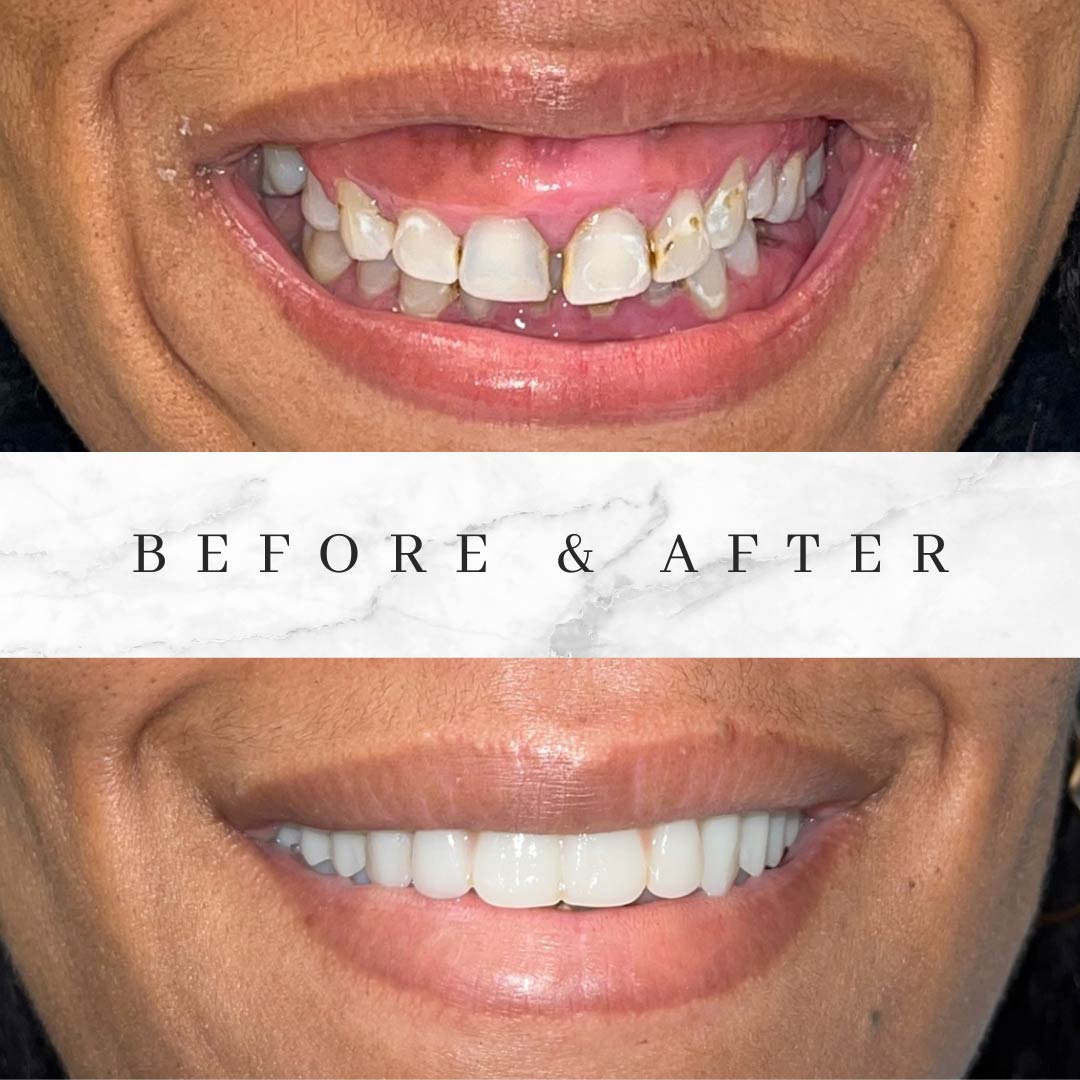 Voit Dental Smile Gallery